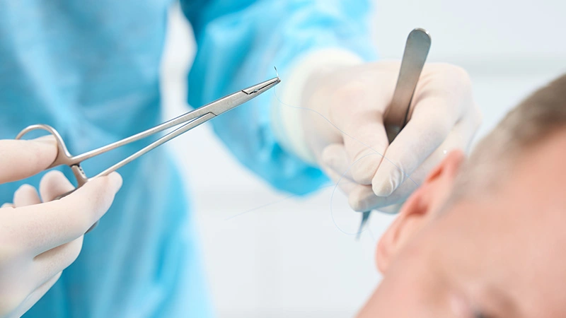 Alternatives to Ear Pinning